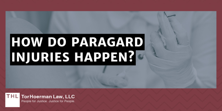 Paragard IUD Lawsuit Settlement Amounts & Payout Info