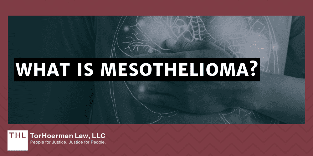 What Is Mesothelioma?