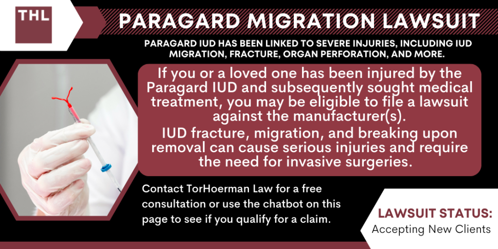 Paragard Migration Injury Lawsuit | #1 Attorneys For Paragard IUD Lawsuits