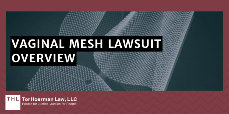 Vaginal Mesh Lawsuit Update [january 2025 Guide]