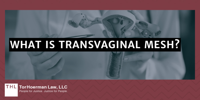 Transvaginal Mesh Settlement Amounts 2024 Update