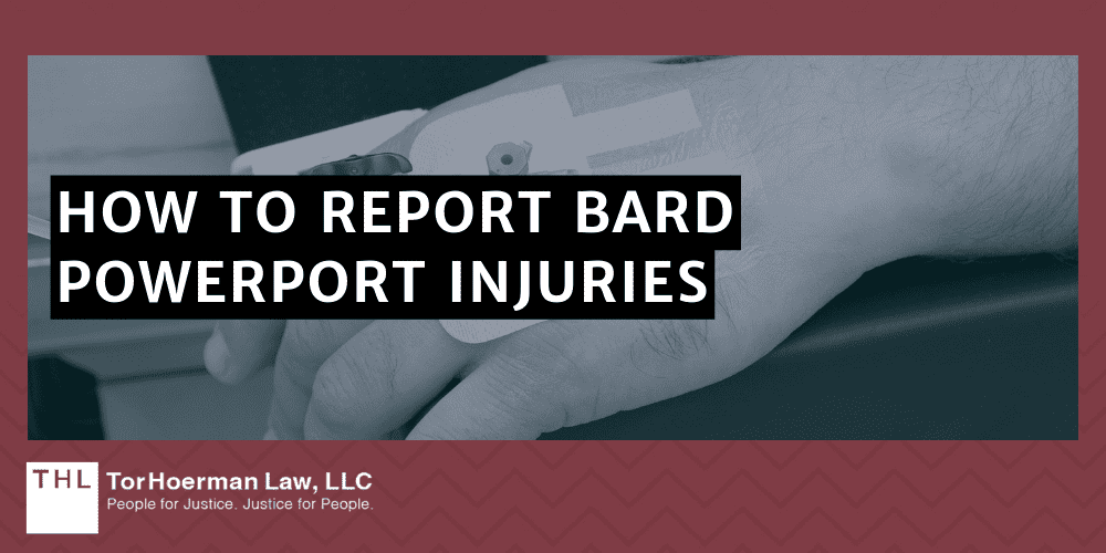 How To Report Bard PowerPort Injuries