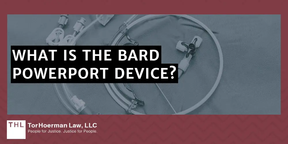 What Is The Bard PowerPort Device