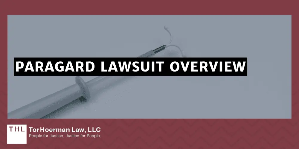 Can I File a Lawsuit if My IUD Broke During Removal; IUD Broke During Removal; Paragard Lawsuit; Paragard IUD Lawsuits; Paragard IUD Lawsuit; Overview Of The Paragard IUD And Potential Complications; Potential For Paragard IUD Breakage During Removal; Paragard Lawsuit Overview