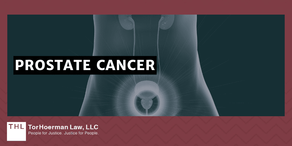 PCBs and Cancer; PCB Lawsuit; Monsanto PCB Lawsuit; Are PCBs Carcinogenic; Do PCBs Cause Cancer; PCB Exposure Lawsuit; Polychlorinated Biphenyls (PCBs) And Cancer; Mechanisms of Carcinogenesis How PCBs Cause Cancer; The Types Of Cancer Linked To PCB Exposures; Liver Cancer; Breast Cancer; Malignant Melanoma; Stomach Cancer; Intestinal Cancer; Thyroid Cancer; Non-Hodgkin's Lymphoma; Brain Cancer; Lung Cancer; Pancreatic Cancer; Prostate Cancer