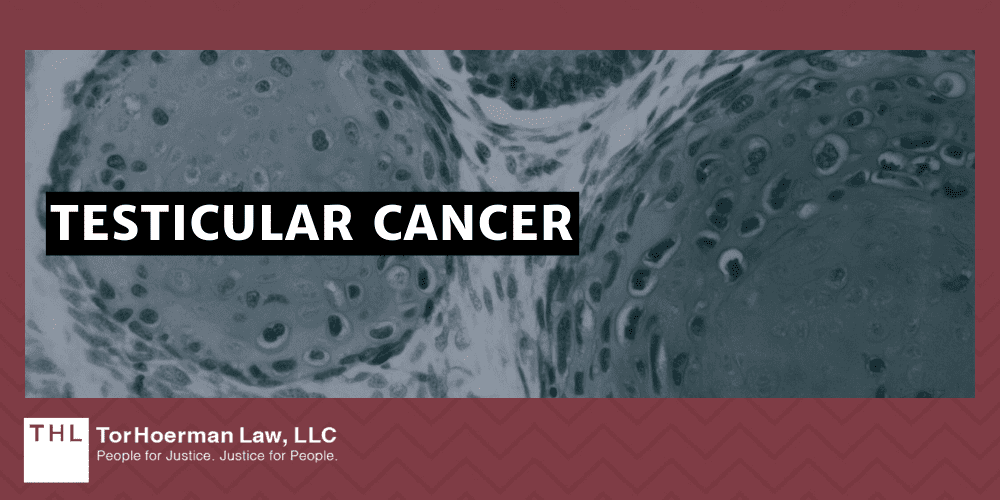 PCBs and Cancer; PCB Lawsuit; Monsanto PCB Lawsuit; Are PCBs Carcinogenic; Do PCBs Cause Cancer; PCB Exposure Lawsuit; Polychlorinated Biphenyls (PCBs) And Cancer; Mechanisms of Carcinogenesis How PCBs Cause Cancer; The Types Of Cancer Linked To PCB Exposures; Liver Cancer; Breast Cancer; Malignant Melanoma; Stomach Cancer; Intestinal Cancer; Thyroid Cancer; Non-Hodgkin's Lymphoma; Brain Cancer; Lung Cancer; Pancreatic Cancer; Prostate Cancer; Testicular Cancer