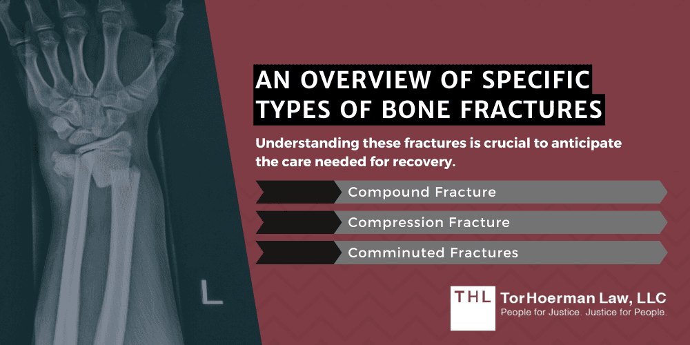 An Overview Of Specific Types Of Bone Fractures