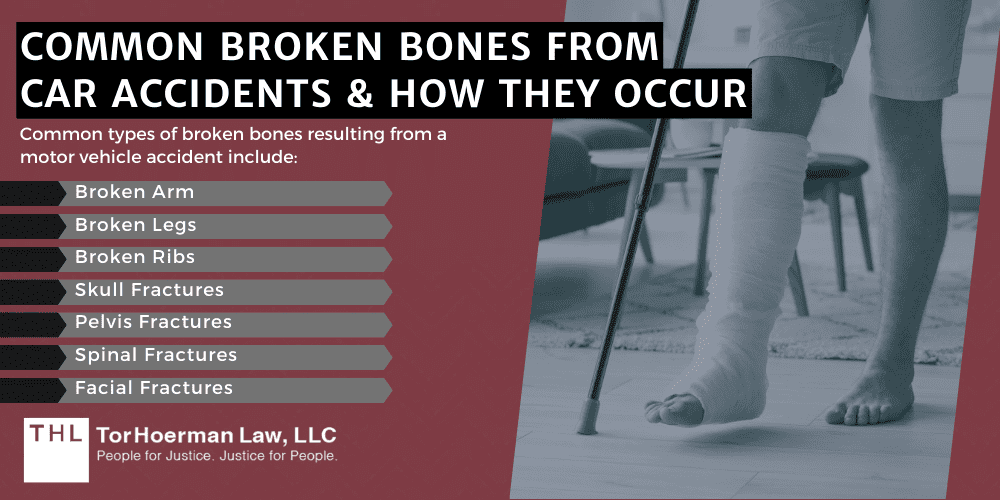 Common Broken Bones From Car Accidents & How They Occur