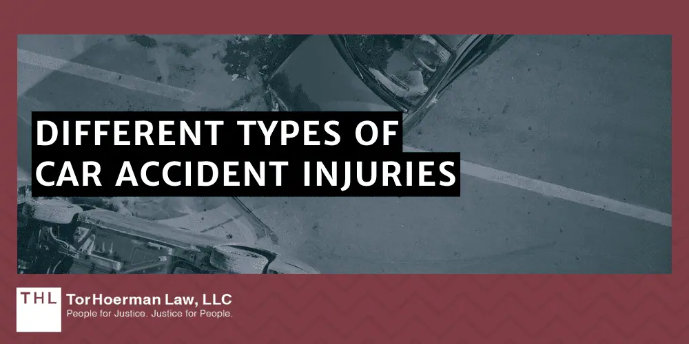 Different Types Of Car Accident Injuries