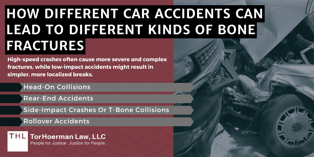 How Different Car Accidents Can Lead To Different Kinds Of Bone Fractures
