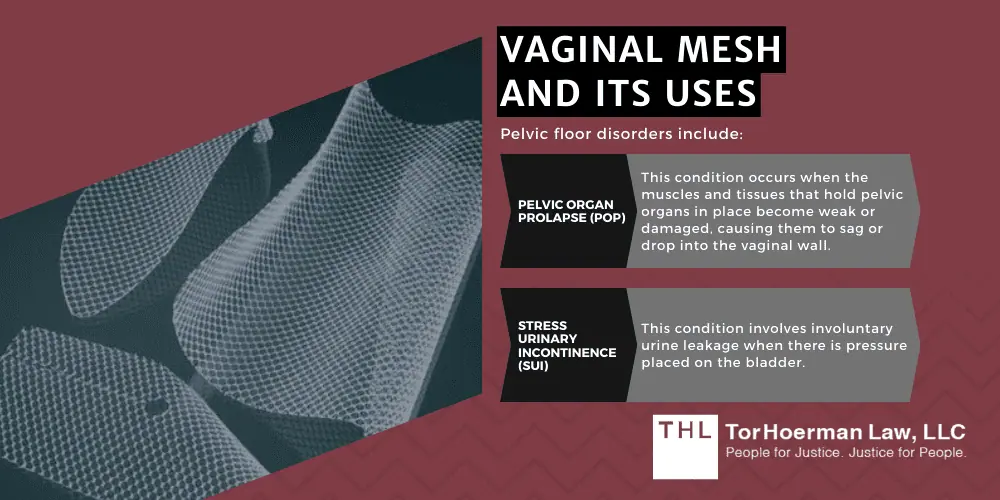 Vaginal Mesh Erosion Lawsuit; vaginal mesh erosion; vaginal mesh lawsuit; transvaginal mesh lawsuit; vaginal mesh complications; vaginal mesh pelvic pain; Vaginal Mesh And Its Uses