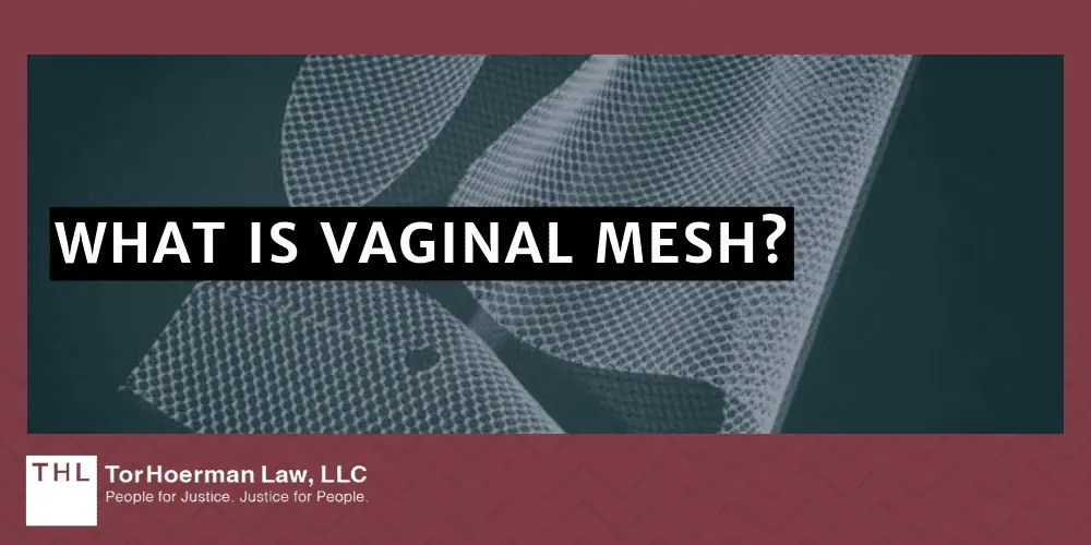 Vaginal Mesh Infection Lawsuit; vaginal mesh infection; transvaginal mesh lawsuit; transavgainal mesh injuries; transvaginal mesh lawyer; vaginal mesh lawsuit; What is Vaginal Mesh