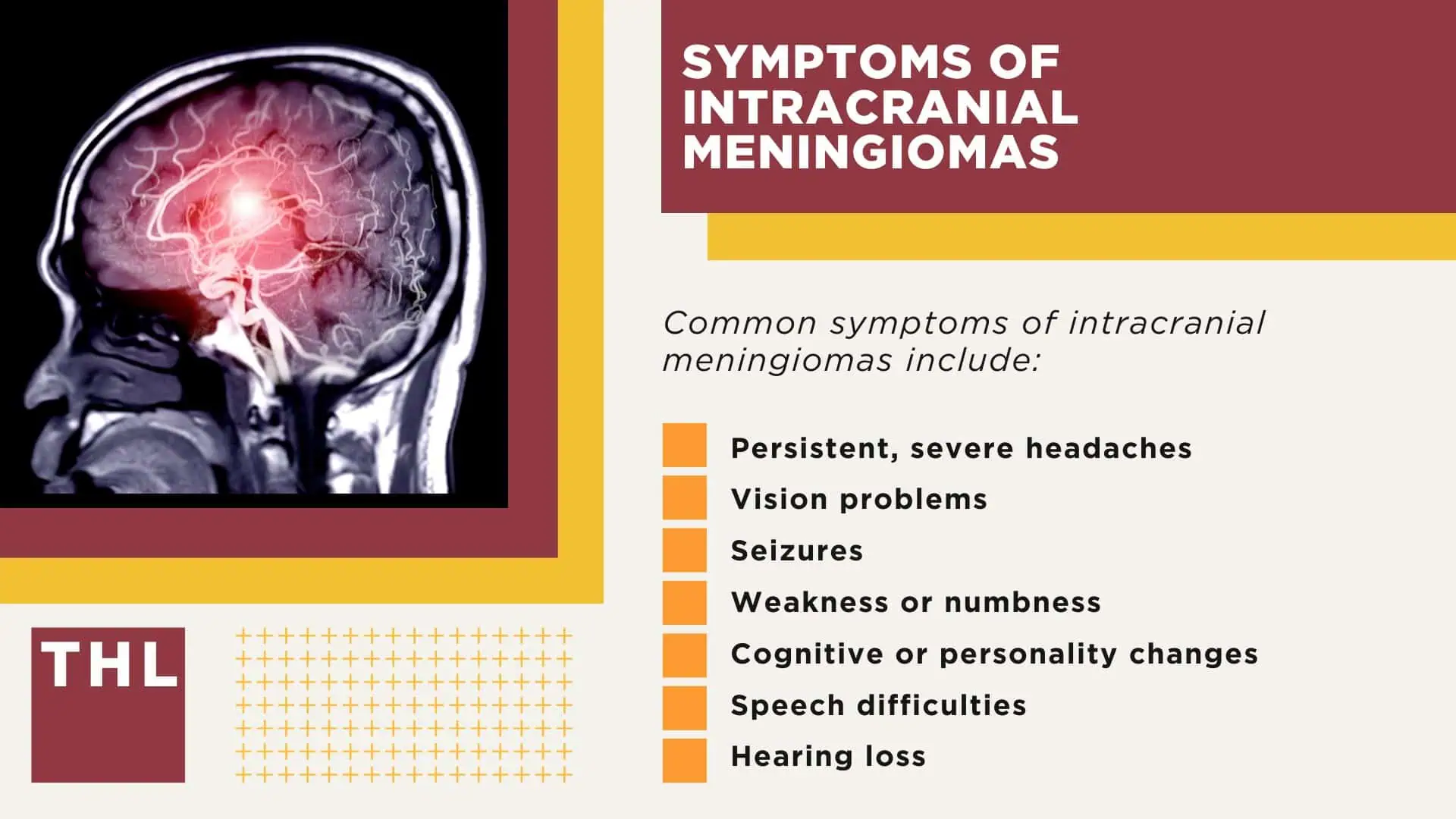 Depo-Provera Lawsuit Settlement Amounts; Estimated Depo-Provera Lawsuit Settlement Amounts; Depo-Provera Lawsuit Overview; Is There a Class Action Lawsuit for Depo-Provera Brain Tumors; Scientific Study Links the Use of Depo-Provera to Brain Tumors; Symptoms of Intracranial Meningiomas