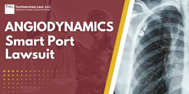 AngioDynamics Smart Port Lawsuit