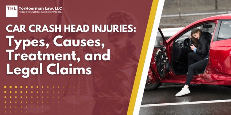 Car Crash Head Injuries Types, Causes, Treatment, and Legal Claims